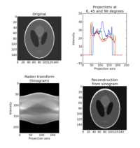 ../_images/plot_radon_transform.png